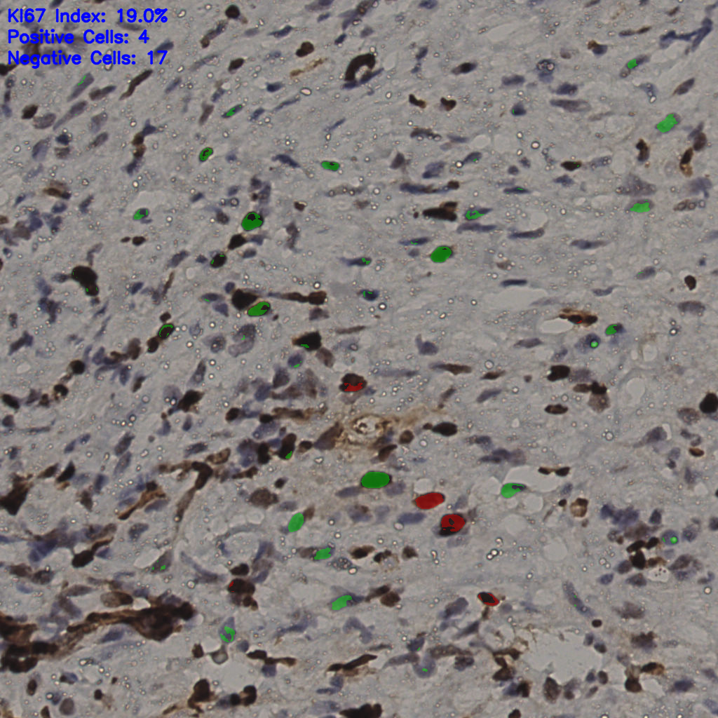 slice_37_10_x33152_y8960.png