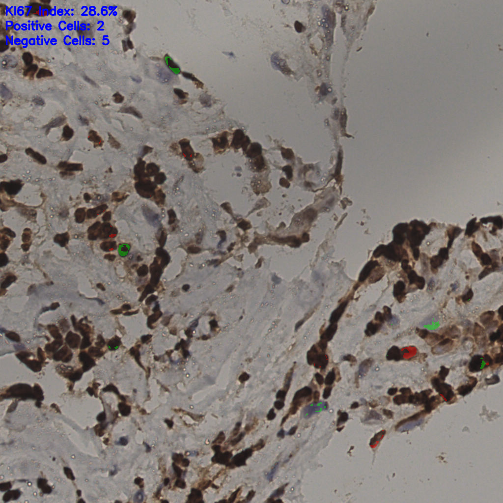 slice_37_13_x33152_y11648.png