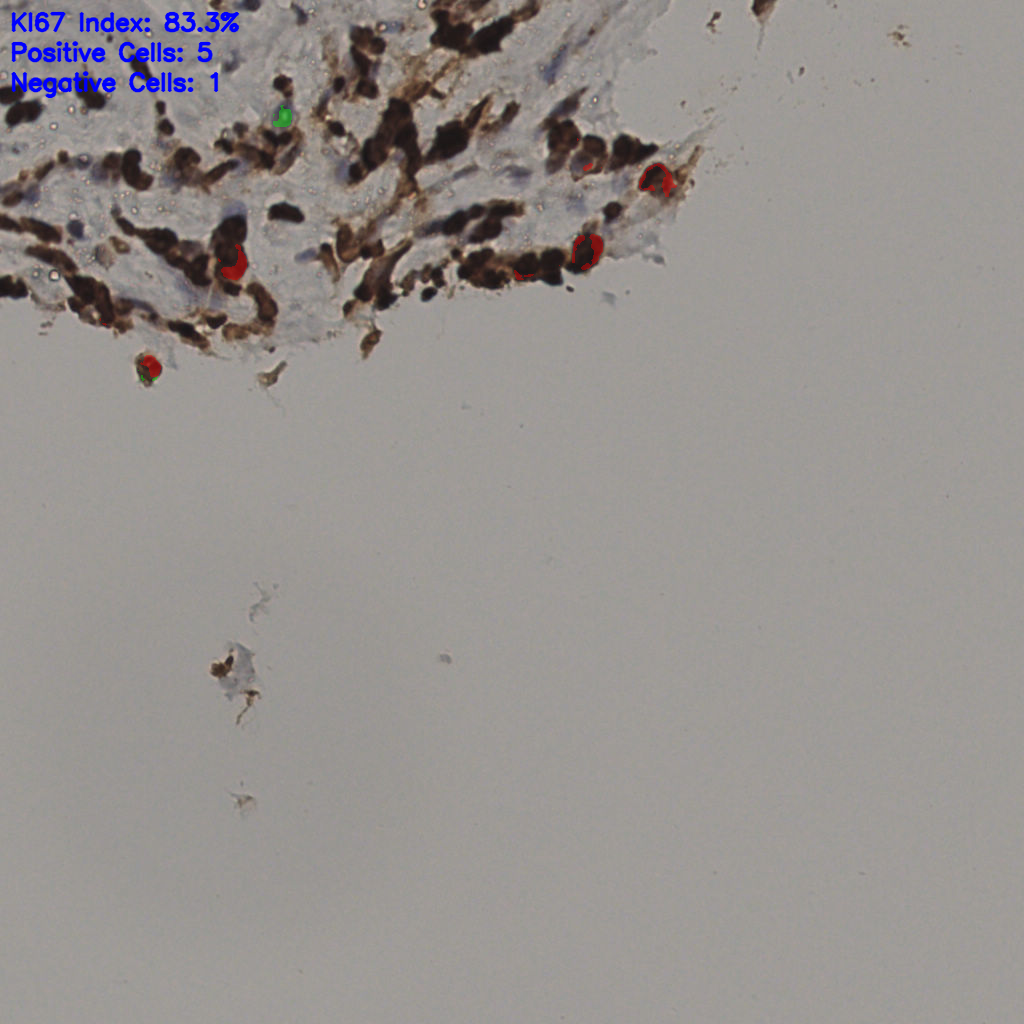 slice_37_14_x33152_y12544.png