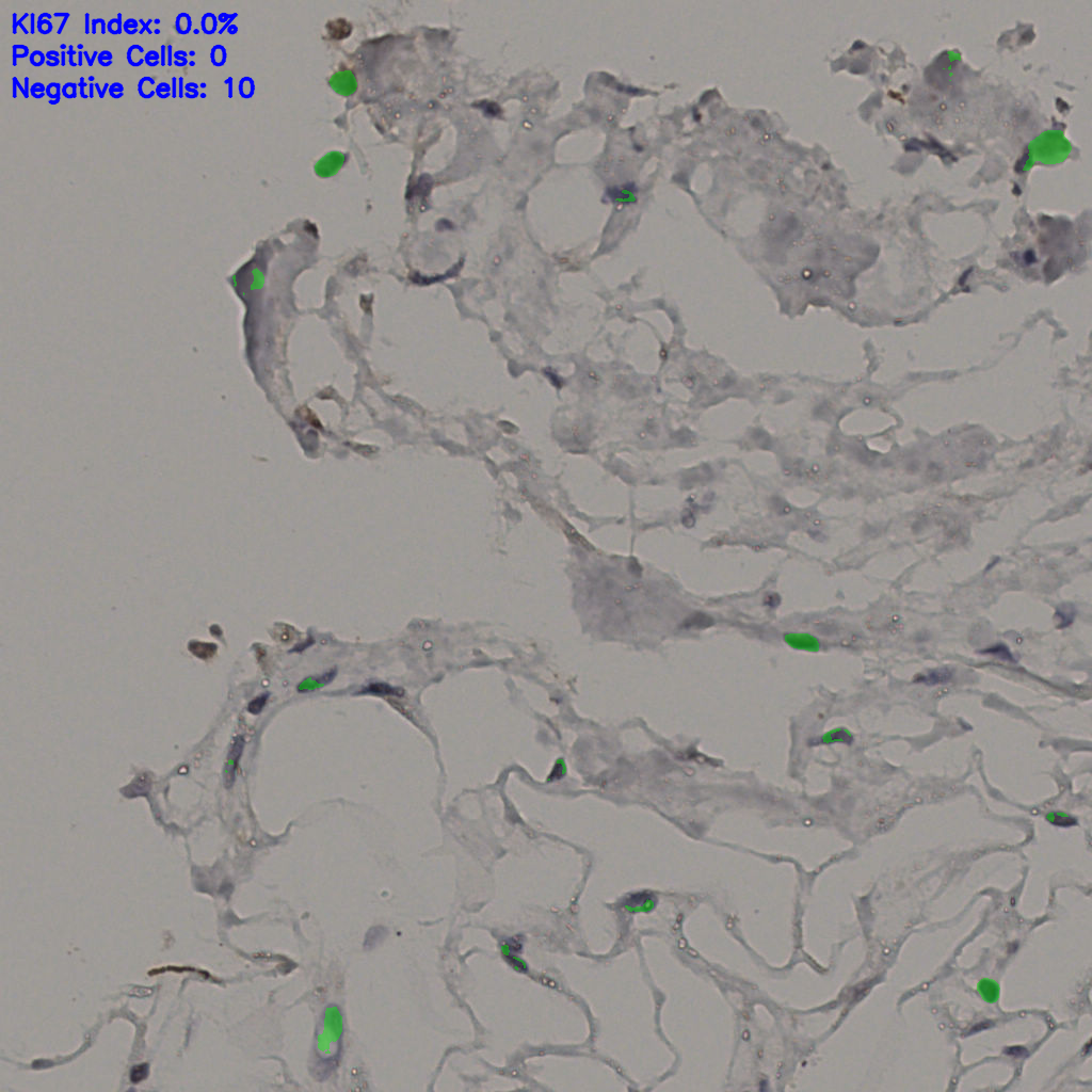 slice_37_17_x33152_y15232.png