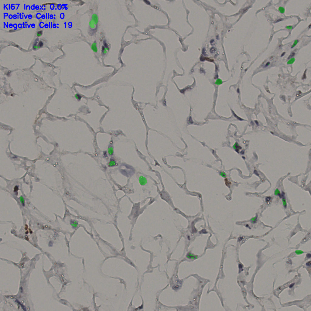 slice_37_18_x33152_y16128.png