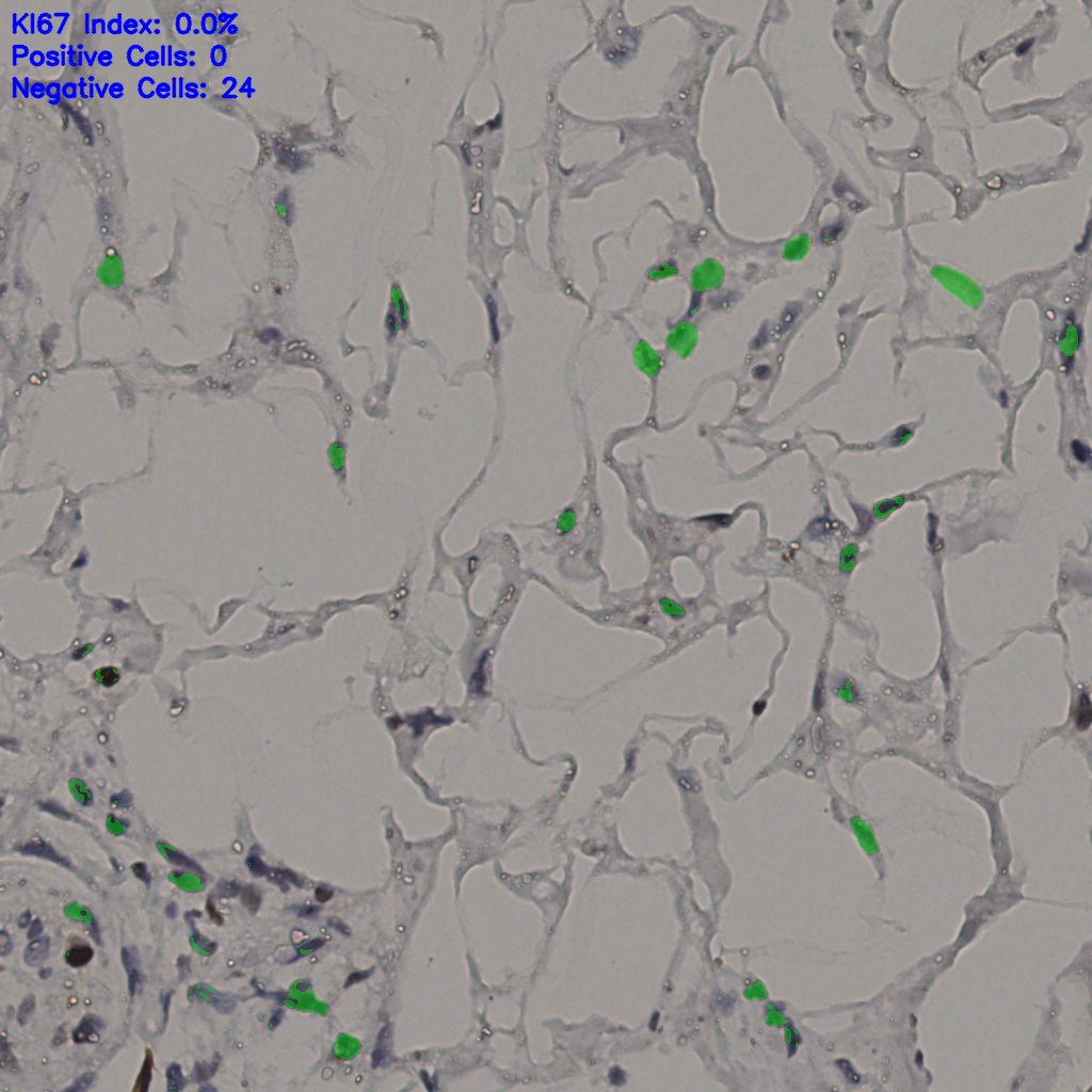 slice_37_19_x33152_y17024.png