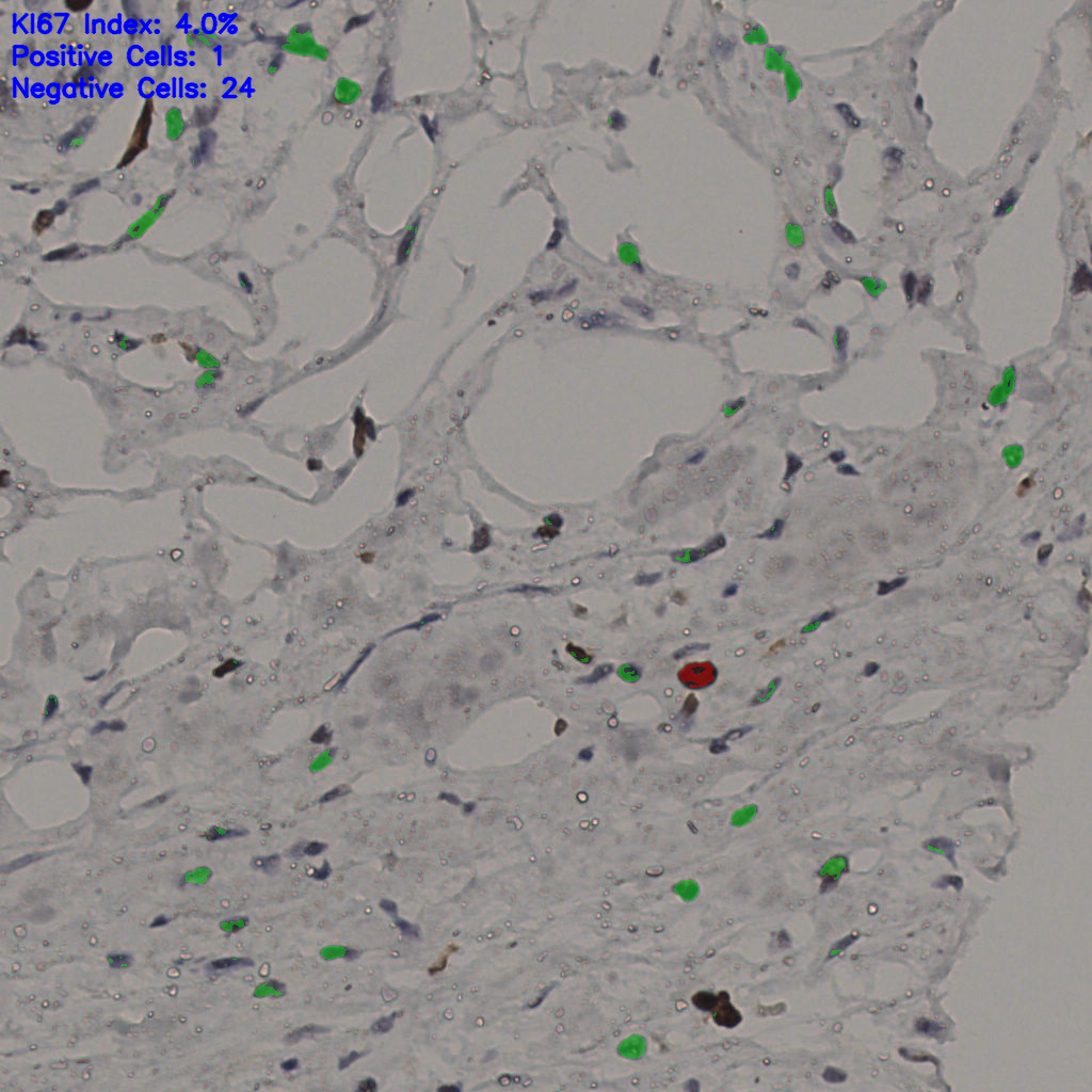 slice_37_20_x33152_y17920.png