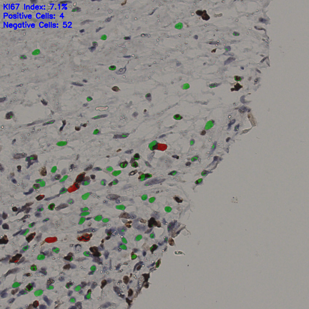 slice_37_21_x33152_y18816.png