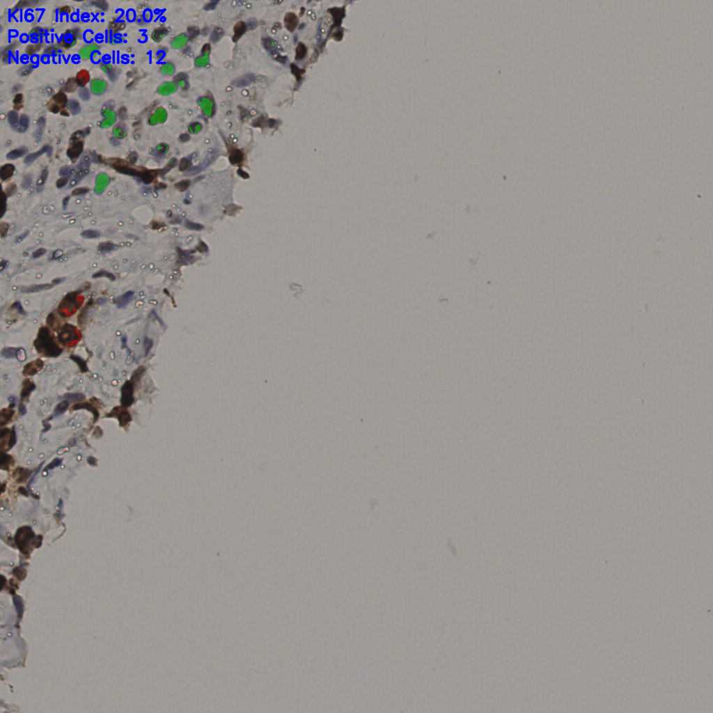 slice_37_22_x33152_y19712.png