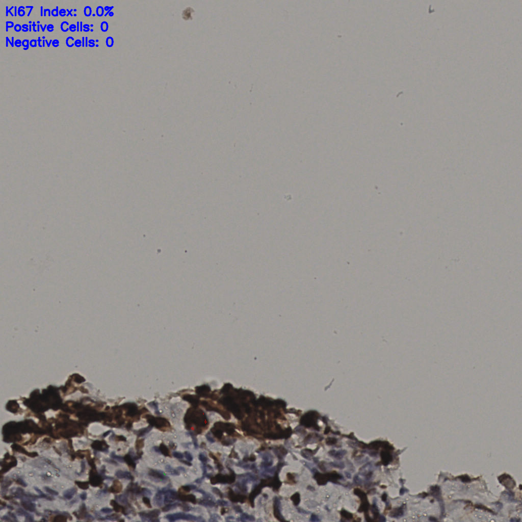 slice_37_3_x33152_y2688.png