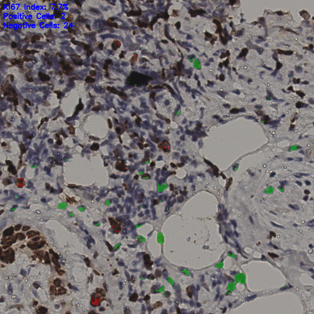 slice_37_4_x33152_y3584.png