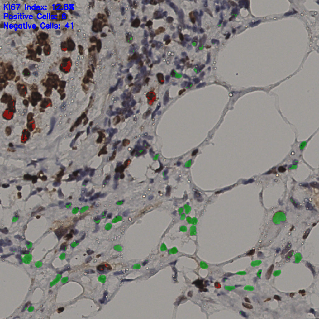 slice_37_5_x33152_y4480.png