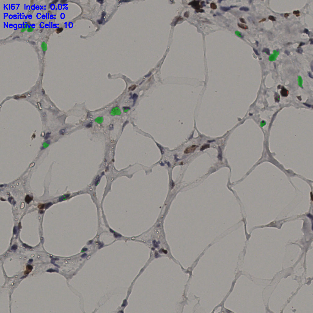slice_37_6_x33152_y5376.png