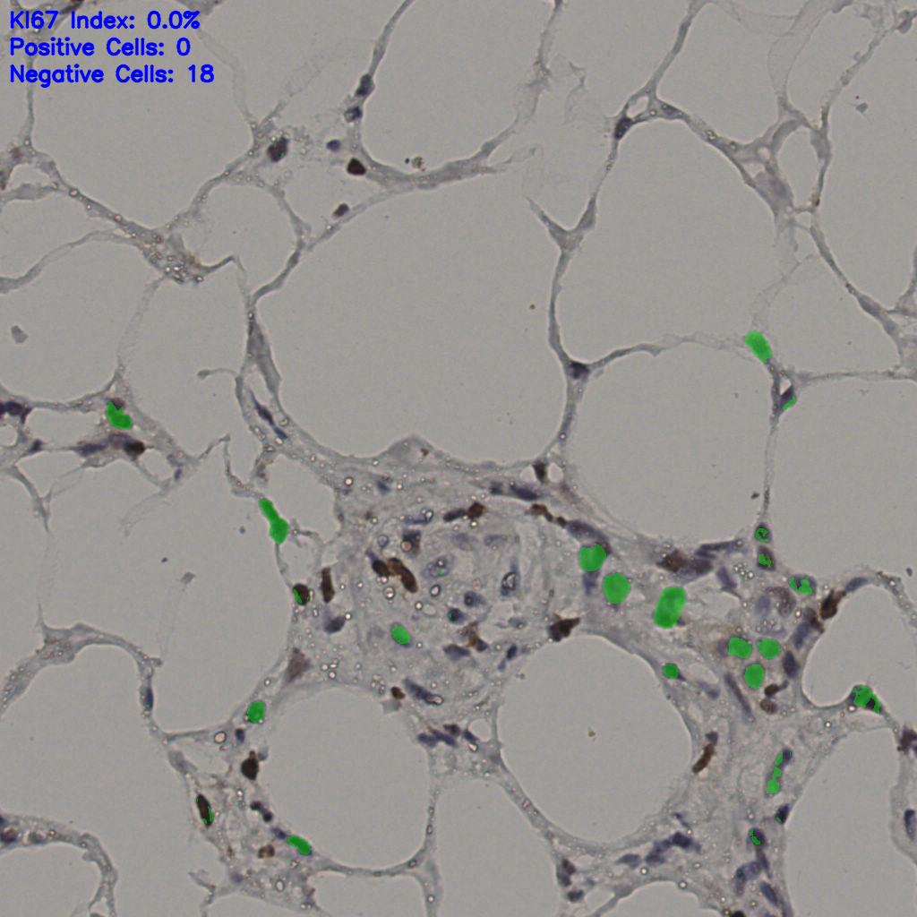 slice_37_7_x33152_y6272.png