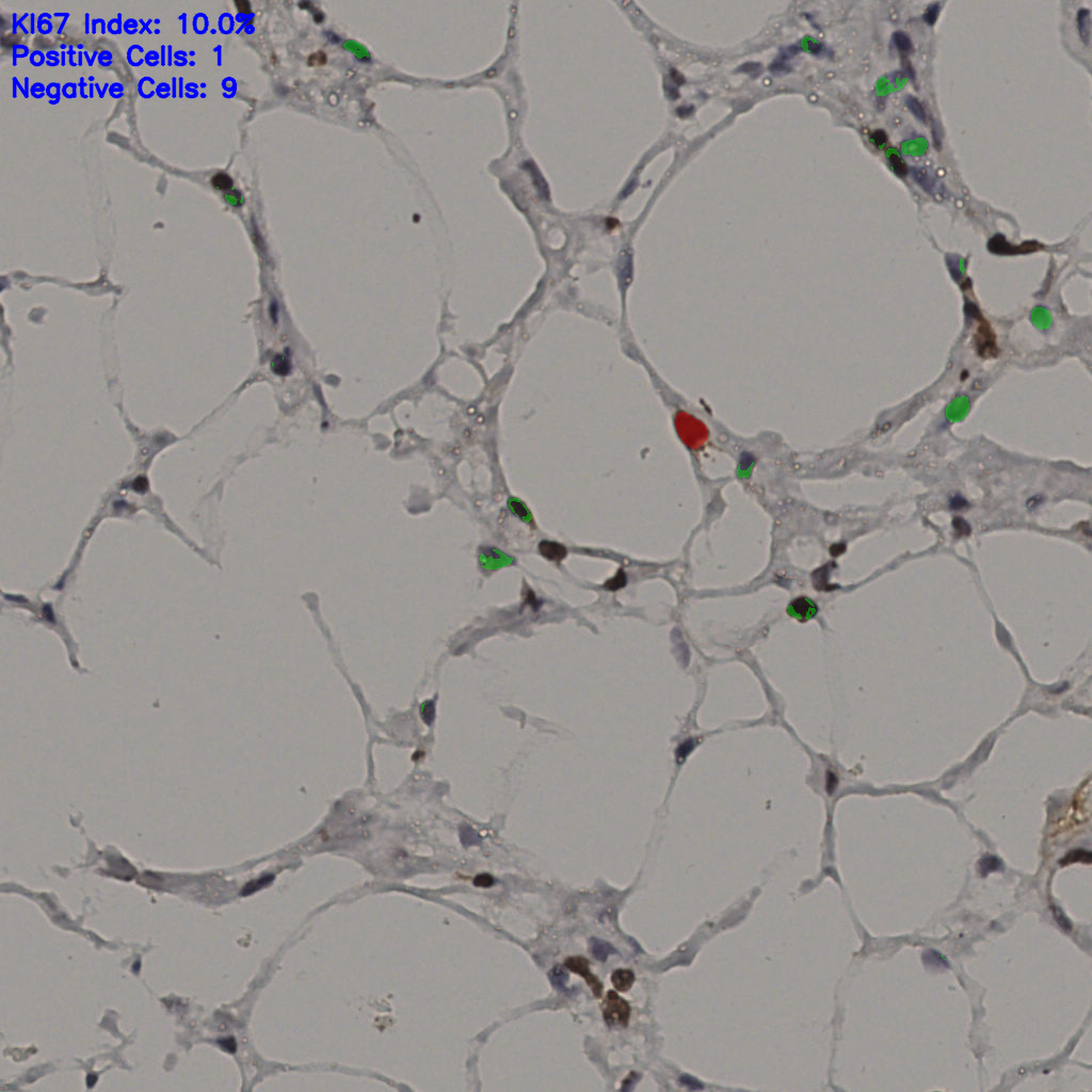 slice_37_8_x33152_y7168.png