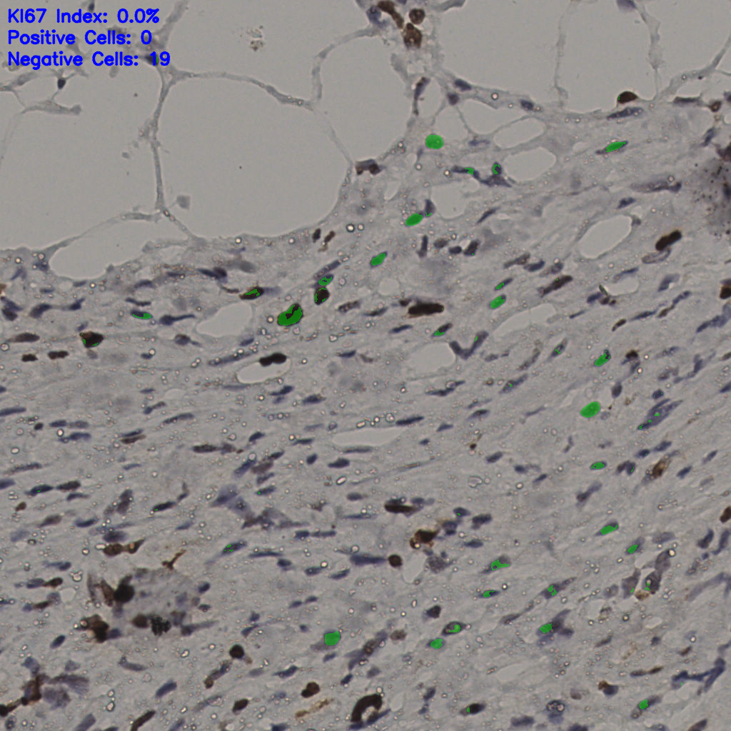slice_37_9_x33152_y8064.png