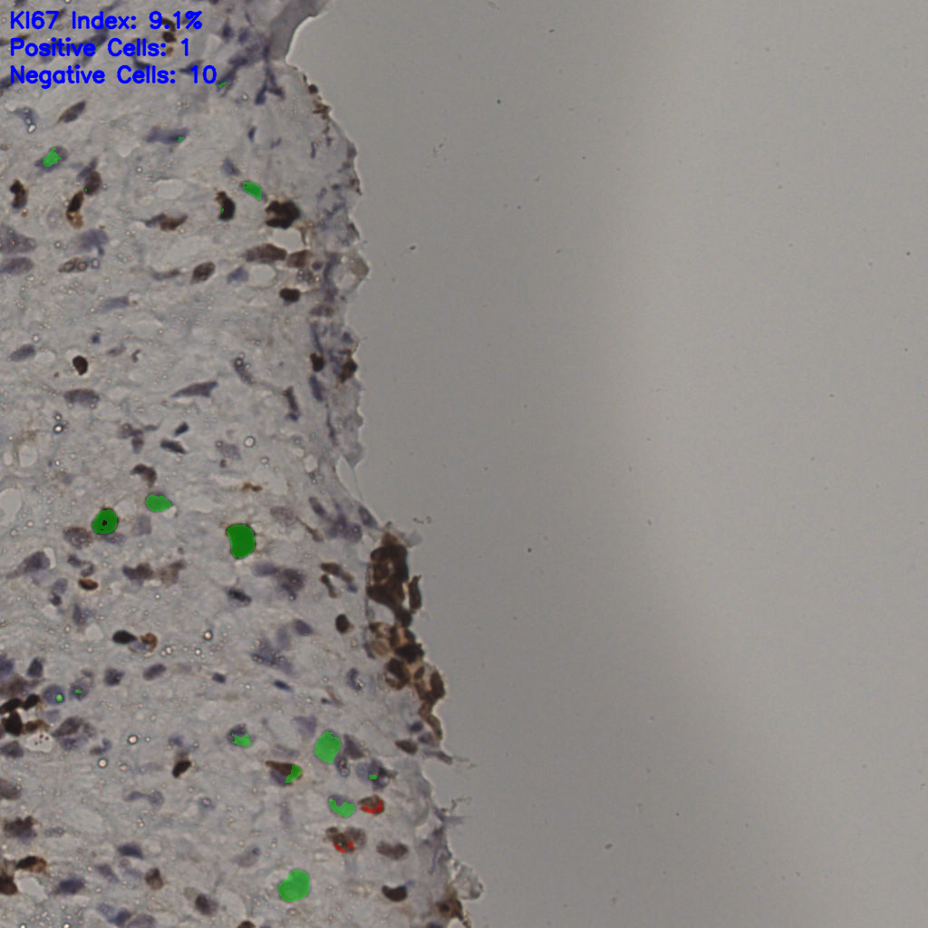 slice_38_10_x34048_y8960.png