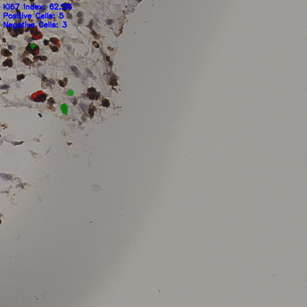 slice_38_12_x34048_y10752.png