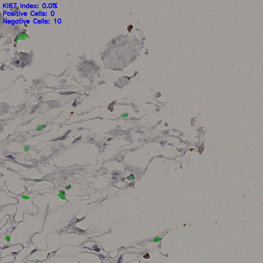 slice_38_17_x34048_y15232.png