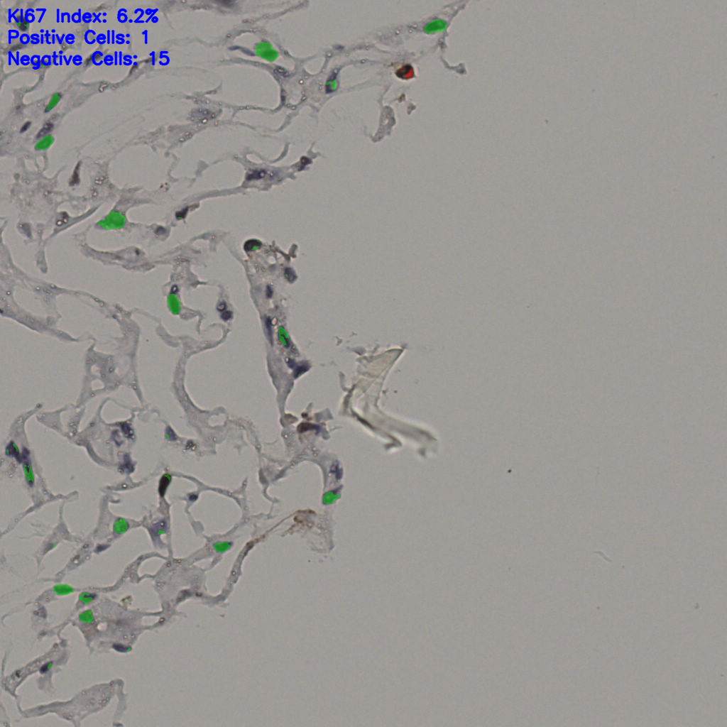 slice_38_18_x34048_y16128.png