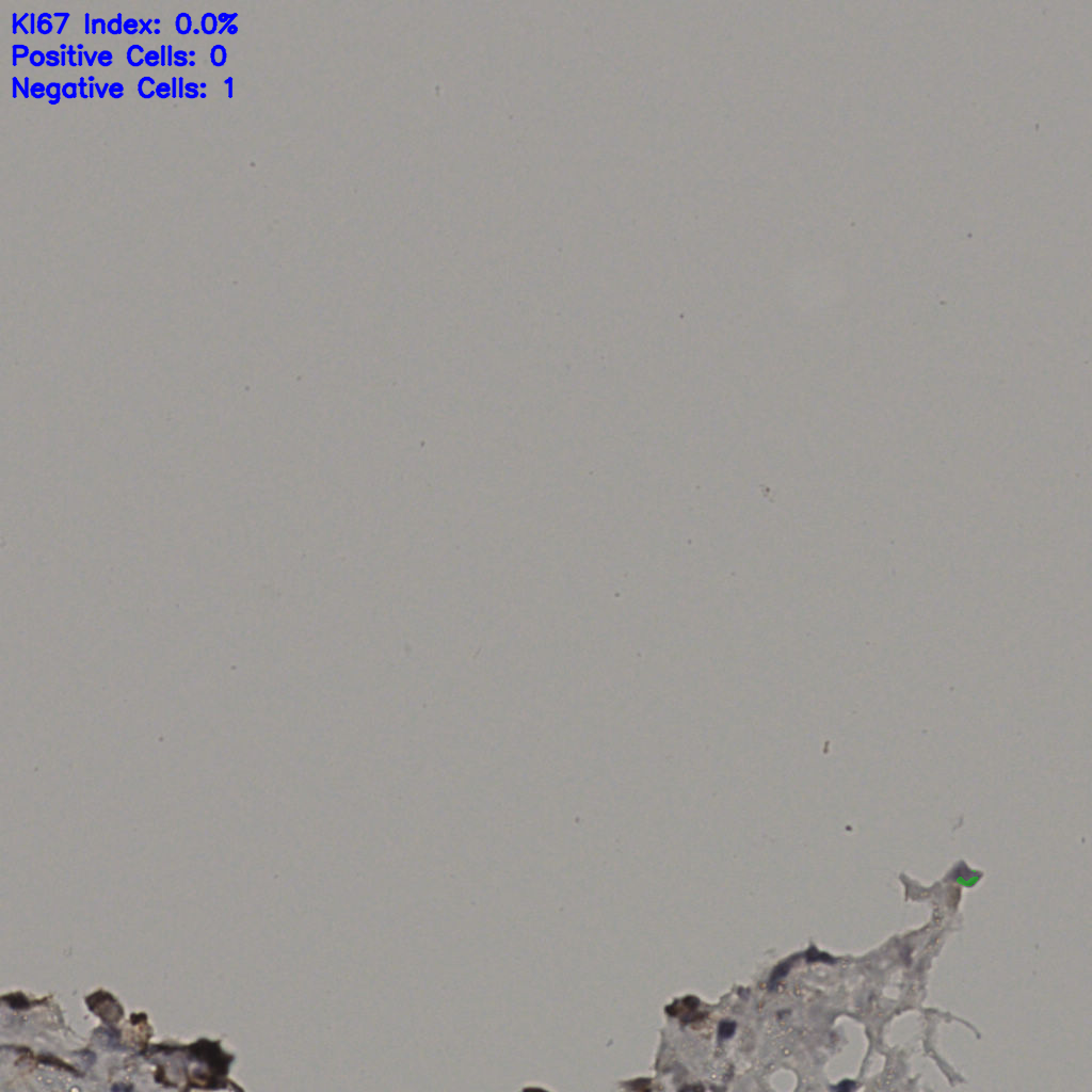 slice_38_3_x34048_y2688.png