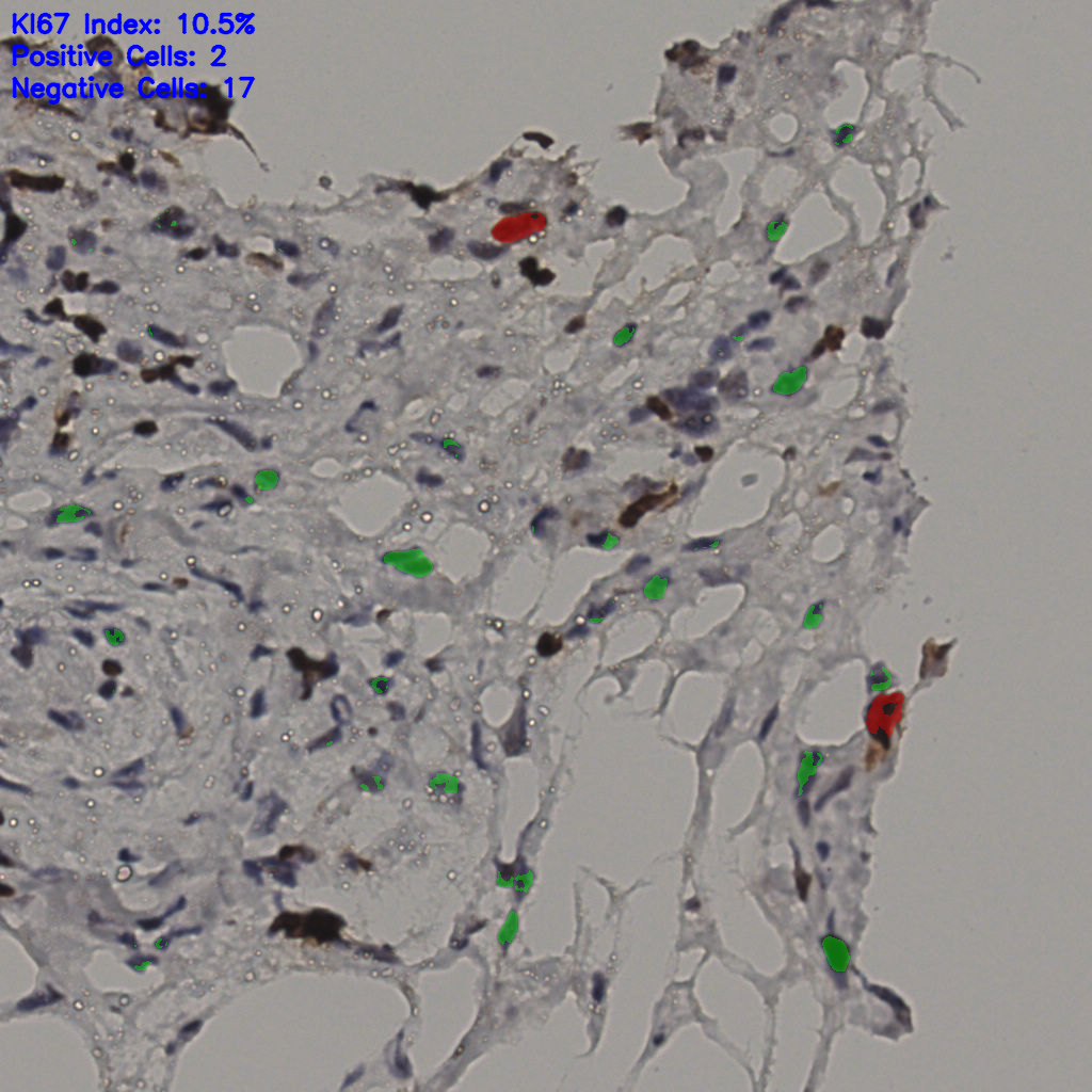 slice_38_4_x34048_y3584.png