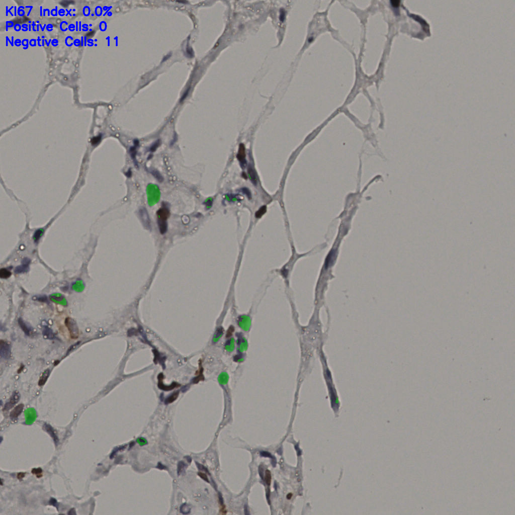 slice_38_5_x34048_y4480.png