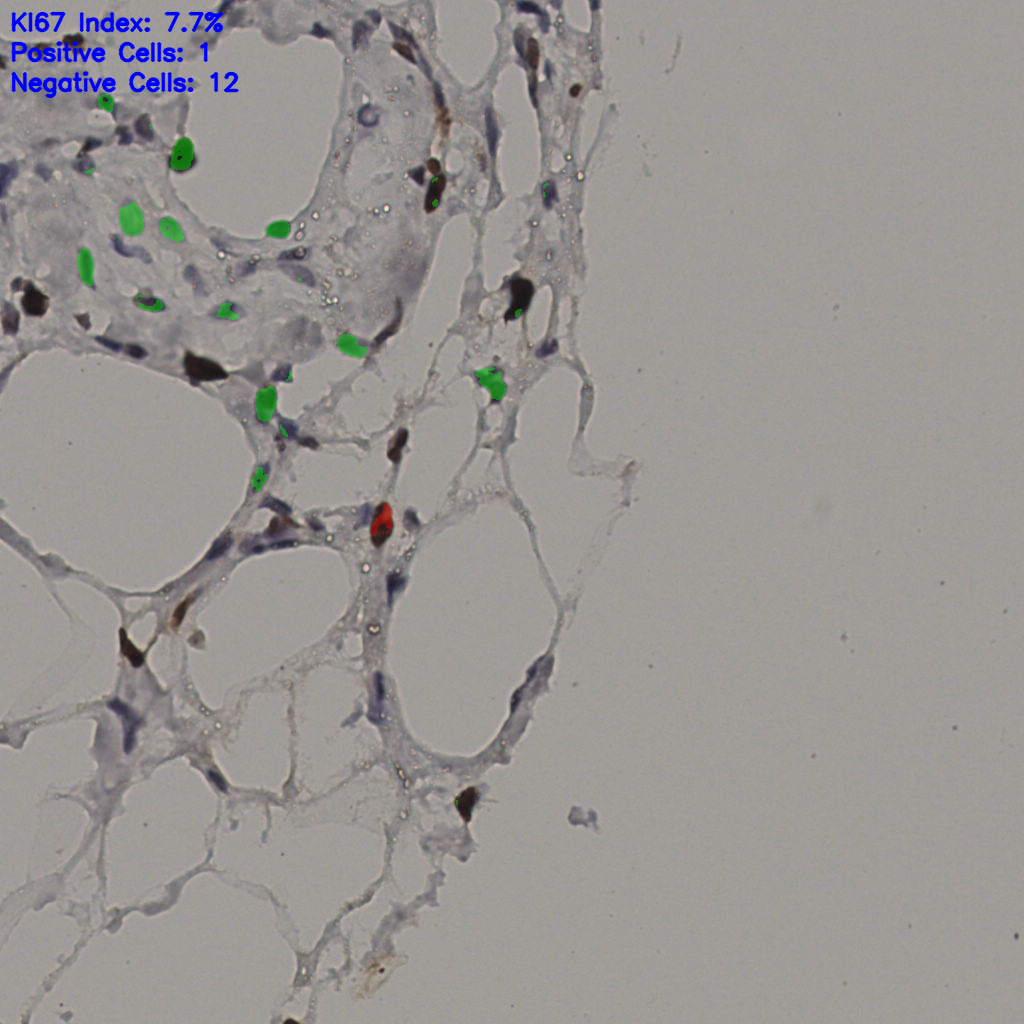 slice_38_6_x34048_y5376.png