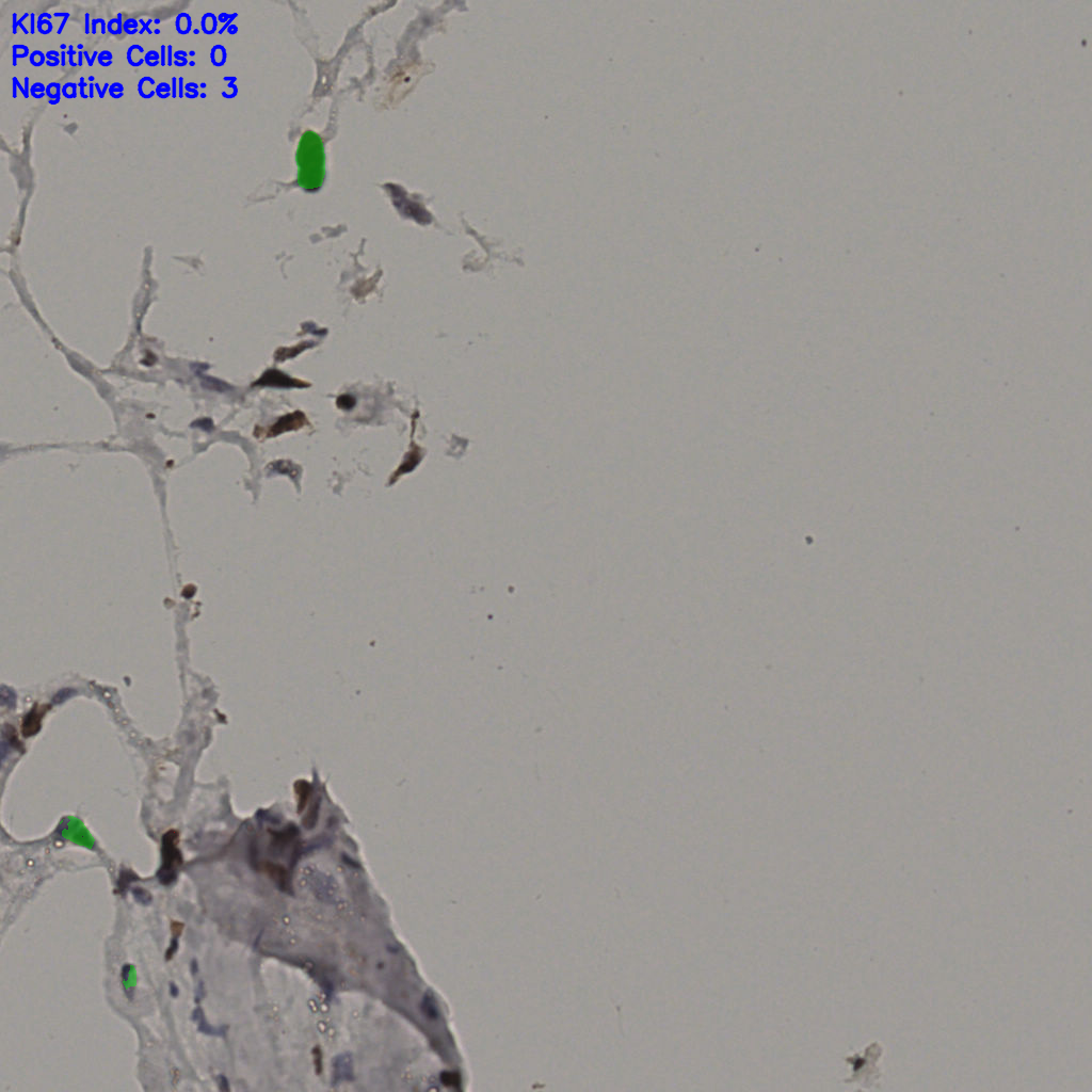 slice_38_7_x34048_y6272.png