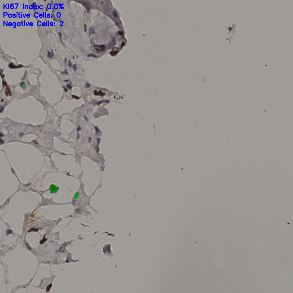 slice_38_8_x34048_y7168.png