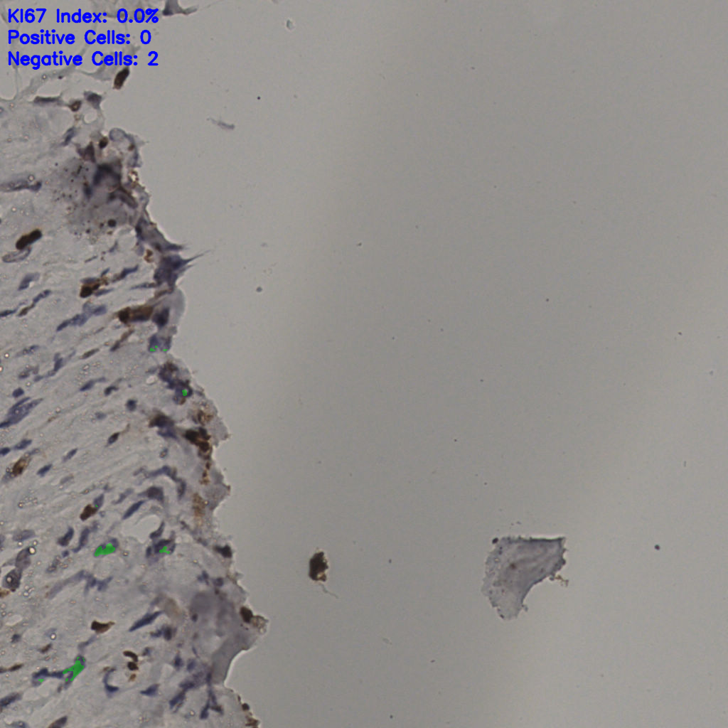 slice_38_9_x34048_y8064.png