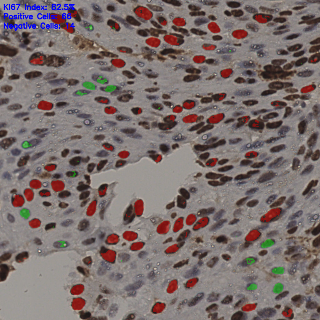 slice_4_59_x3584_y52864.png