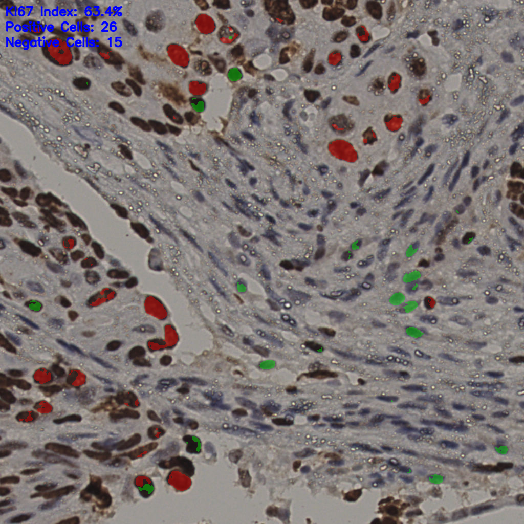 slice_5_58_x4480_y51968.png
