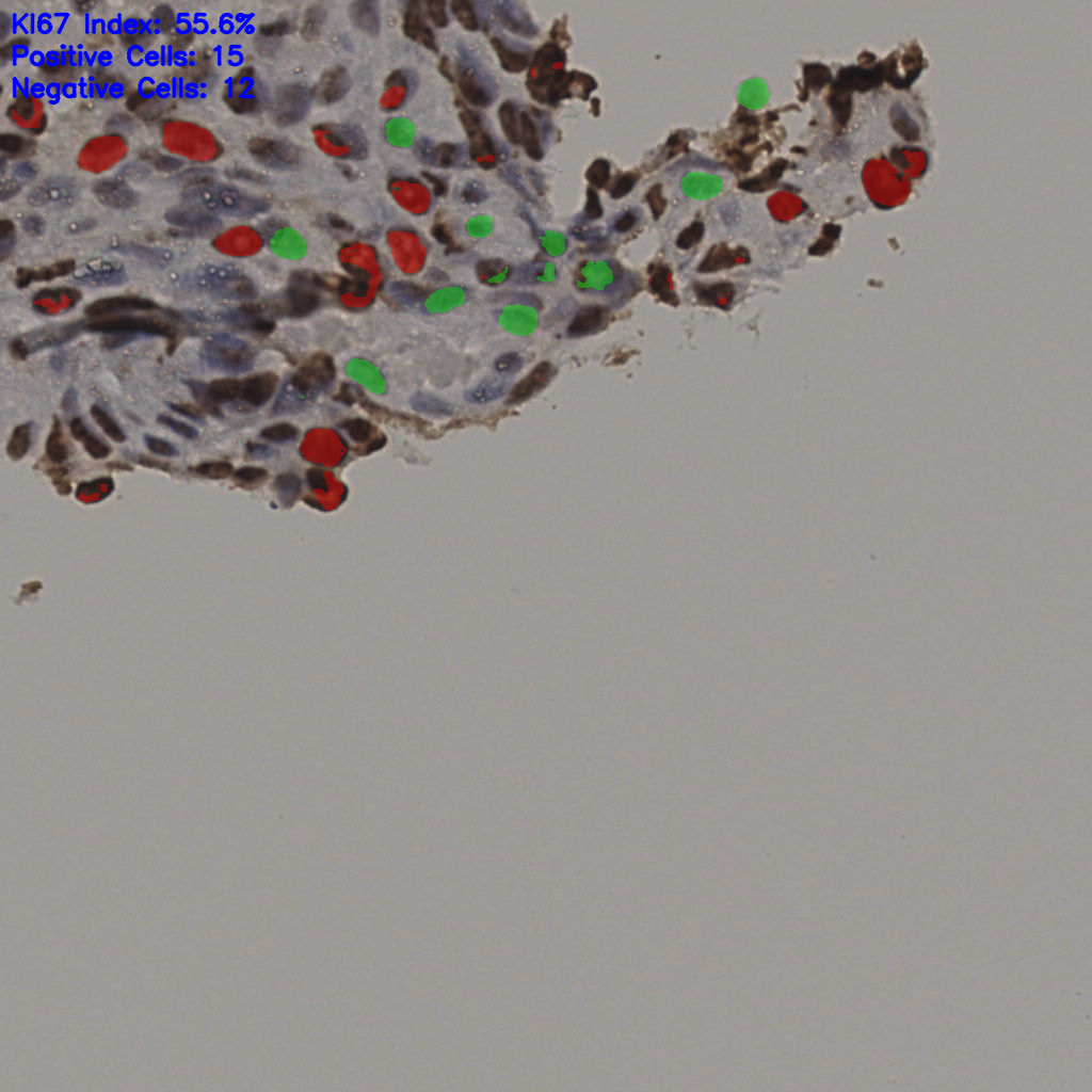 slice_5_60_x4480_y53760.png