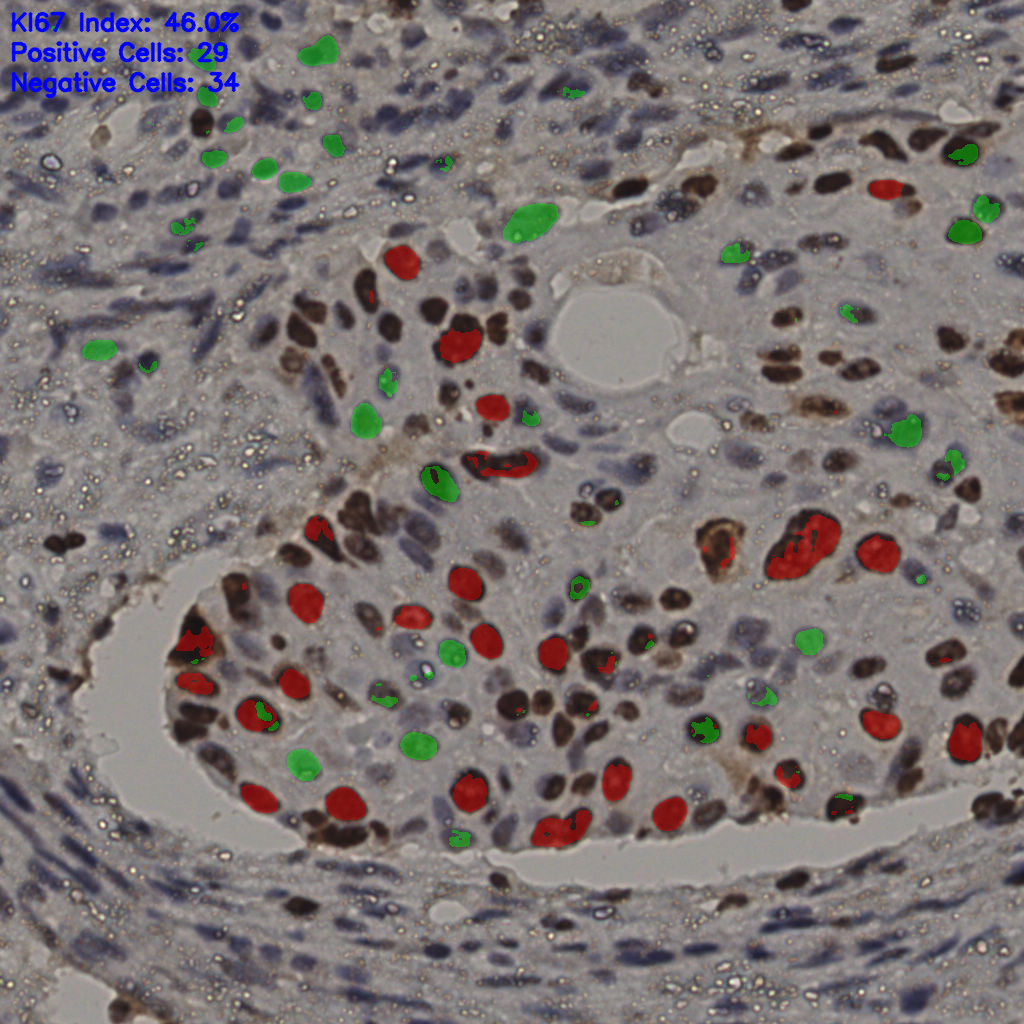 slice_6_56_x5376_y50176.png
