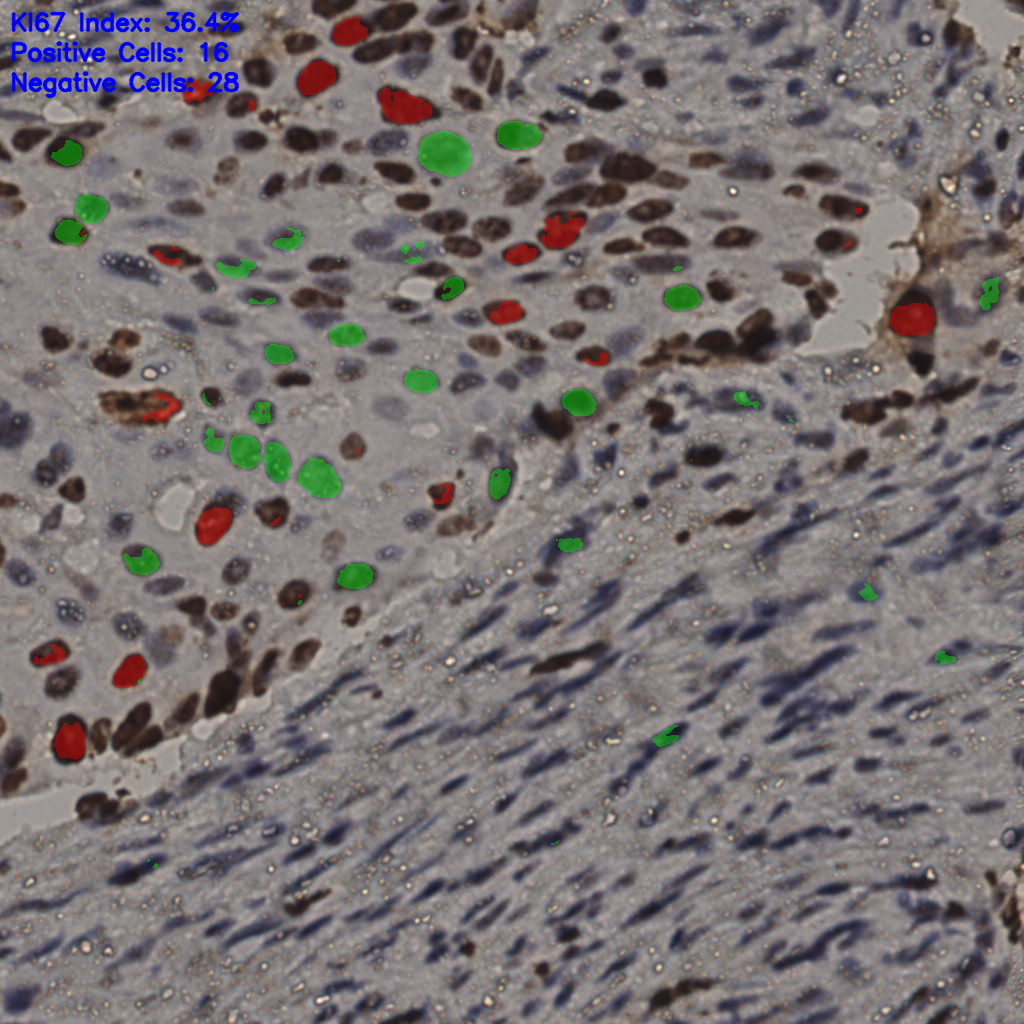 slice_7_56_x6272_y50176.png