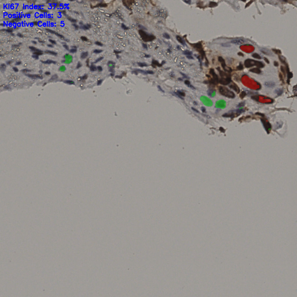 slice_7_59_x6272_y52864.png