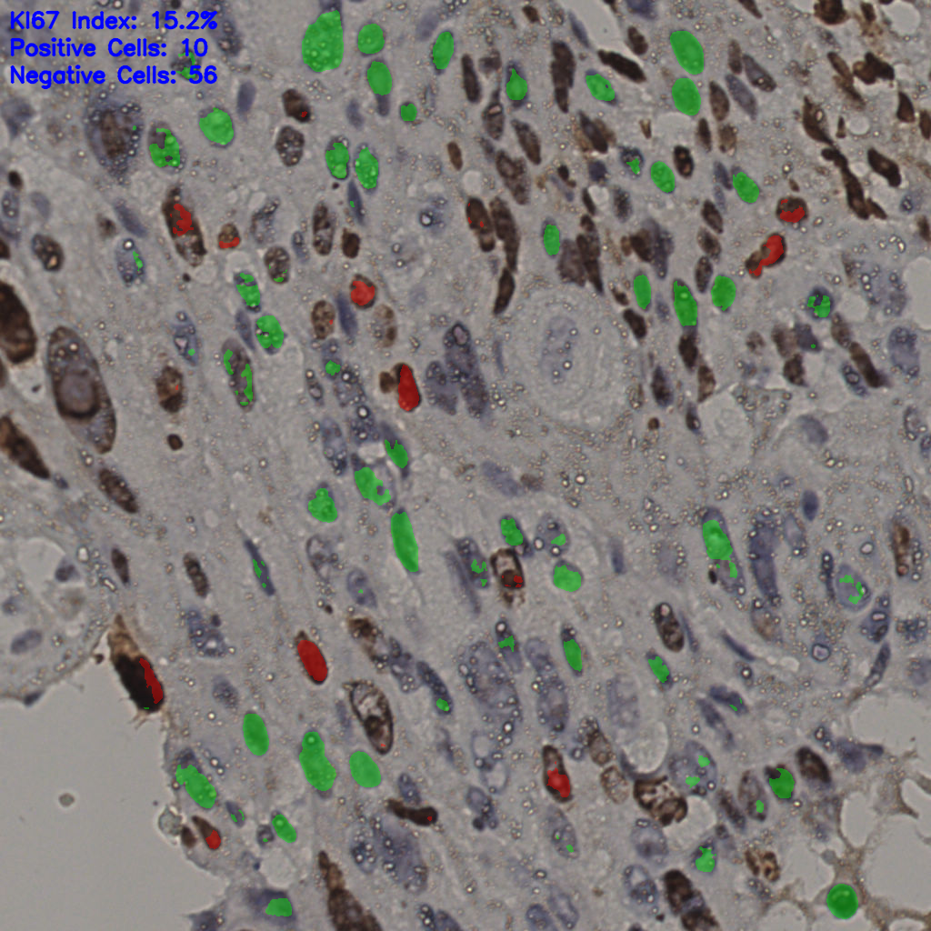 slice_8_50_x7168_y44800.png