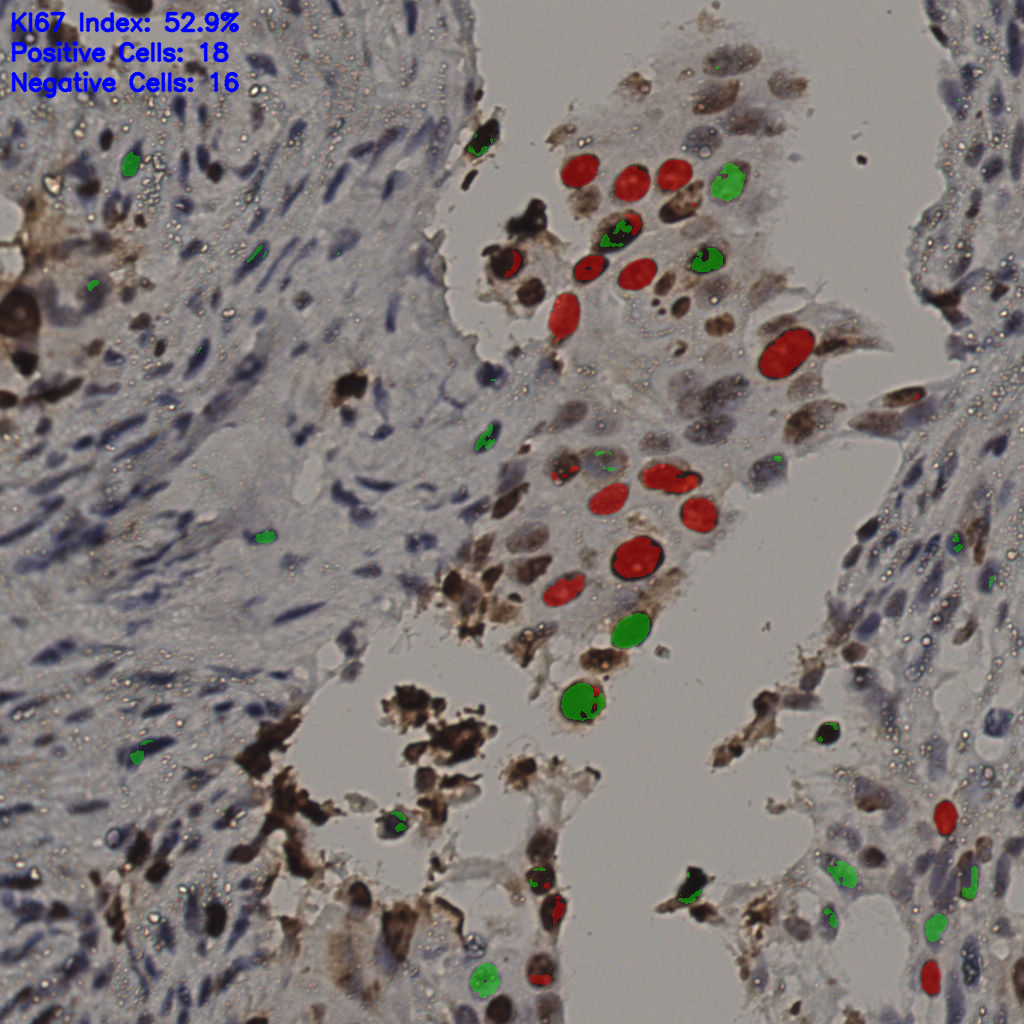 slice_8_56_x7168_y50176.png