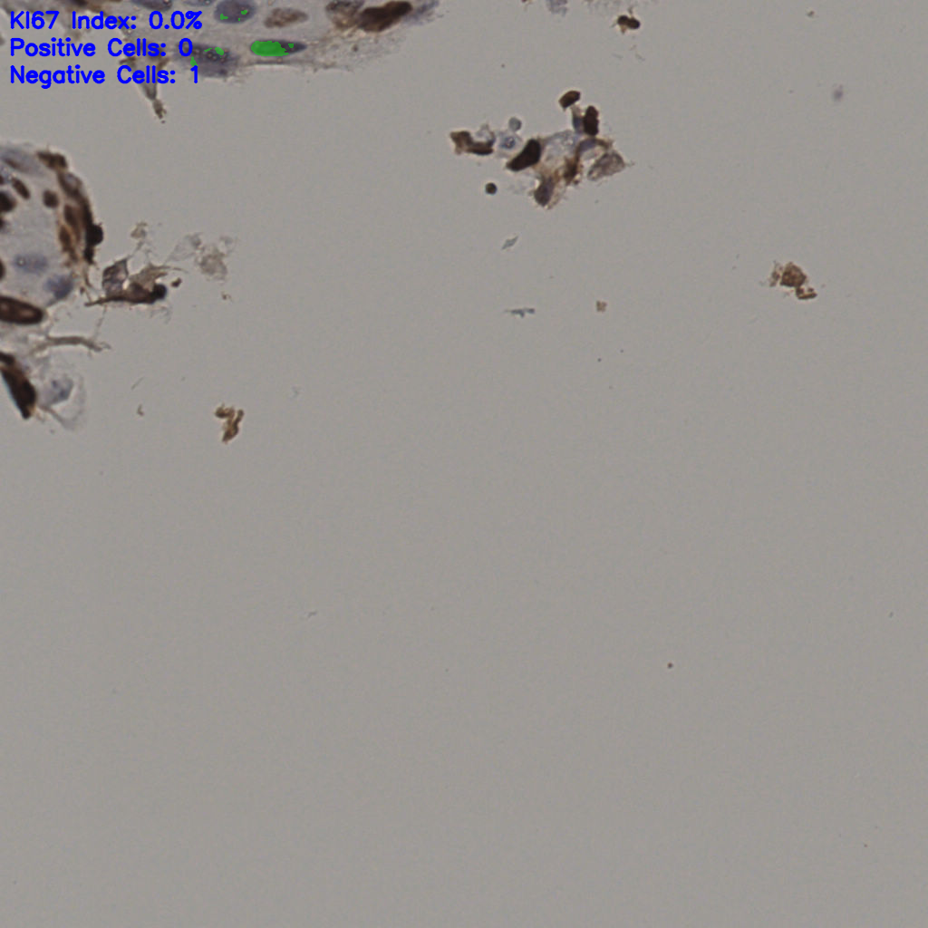 slice_8_59_x7168_y52864.png