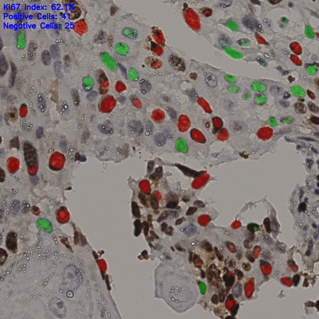 slice_9_53_x8064_y47488.png