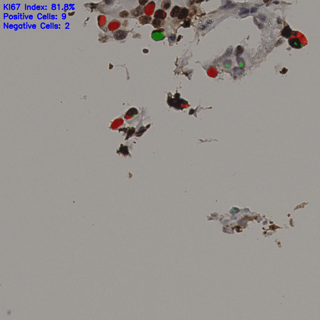 slice_9_58_x8064_y51968.png