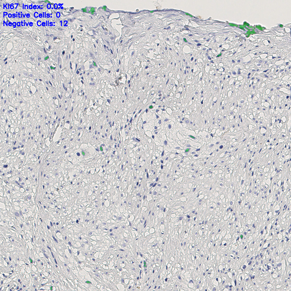 slice_10_19_x8960_y17024.png