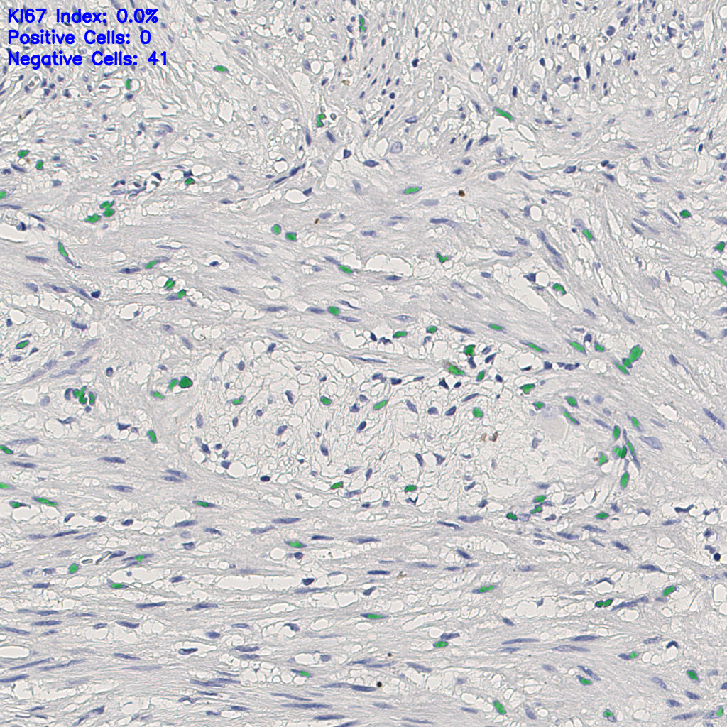 slice_10_20_x8960_y17920.png