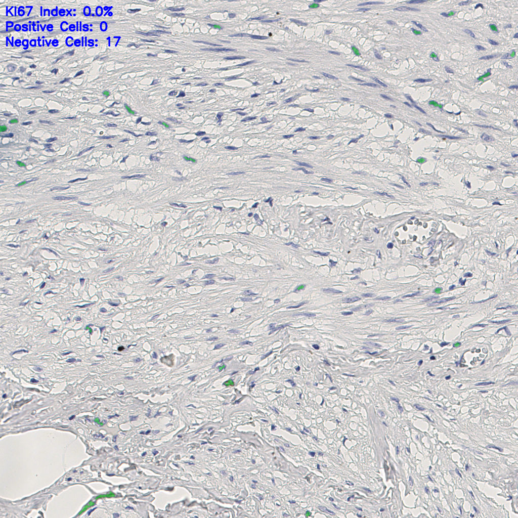slice_10_21_x8960_y18816.png