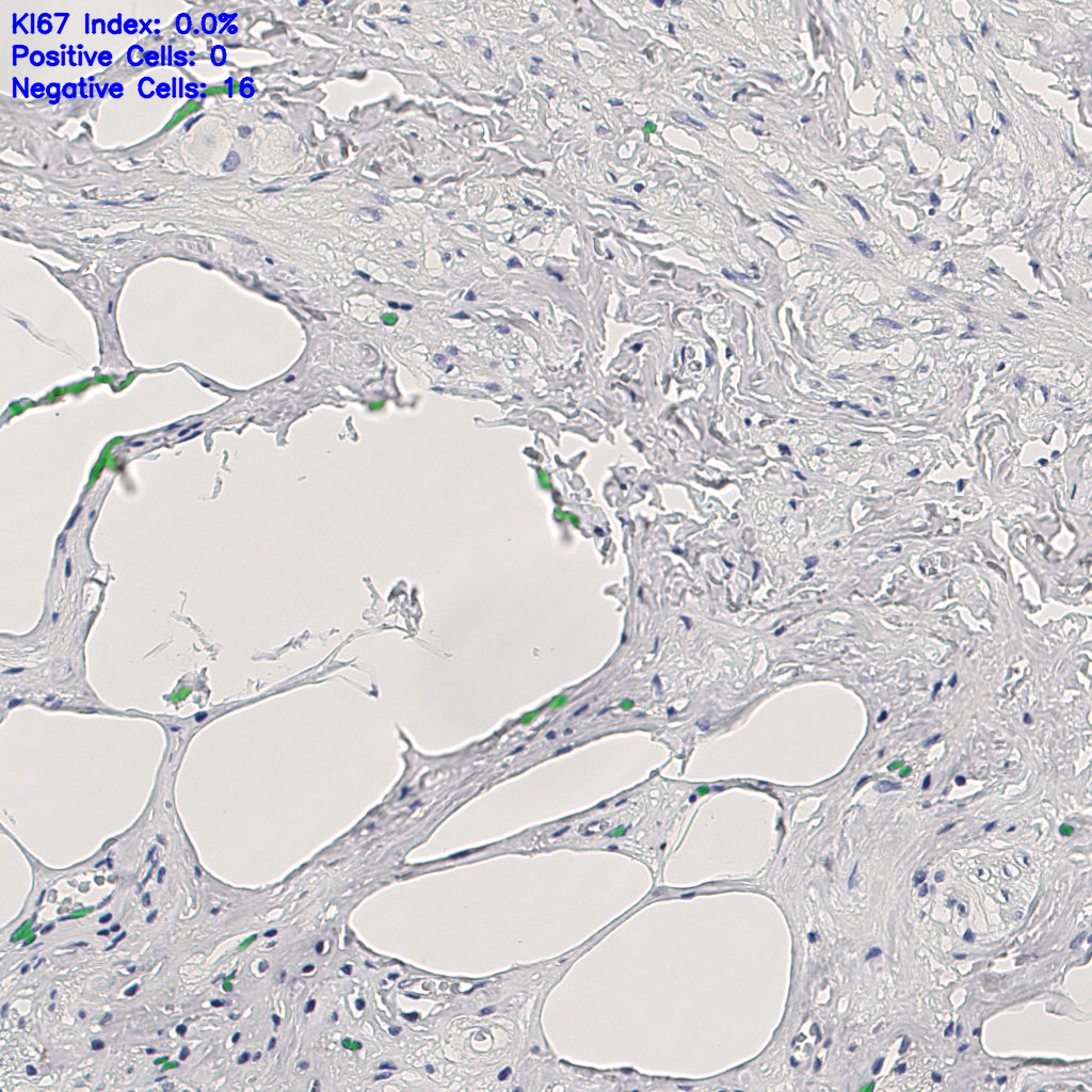 slice_10_22_x8960_y19712.png