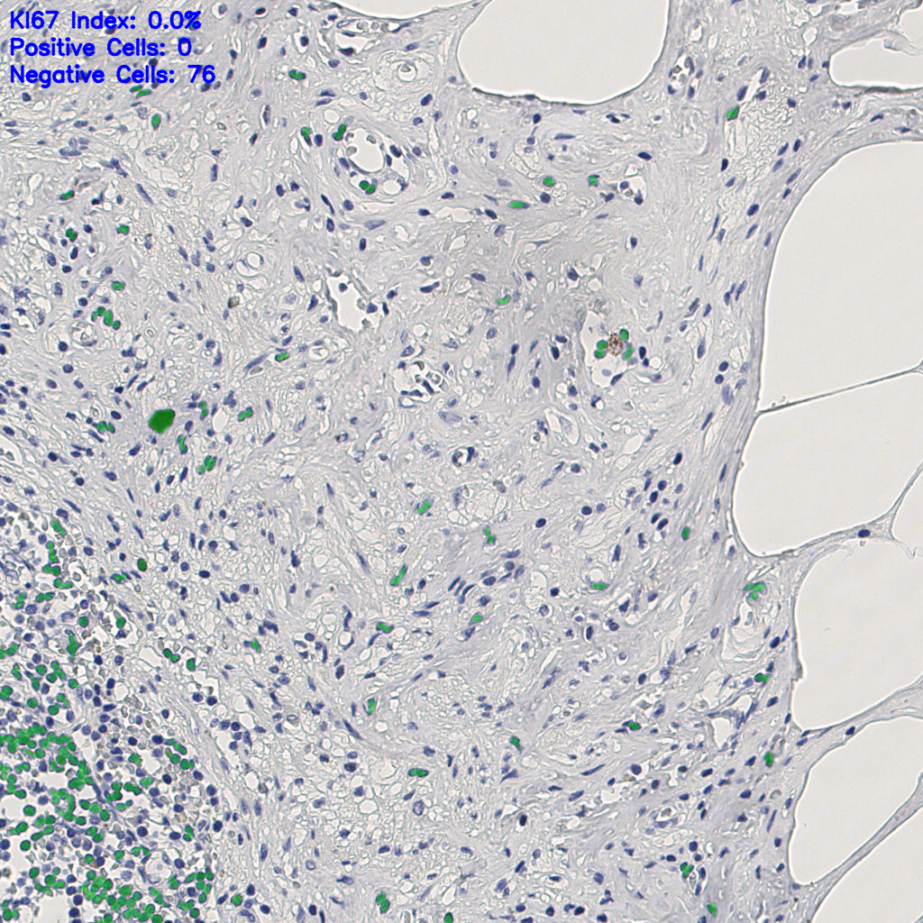 slice_10_23_x8960_y20608.png