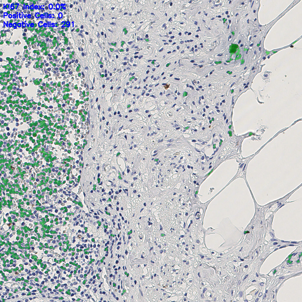 slice_10_24_x8960_y21504.png