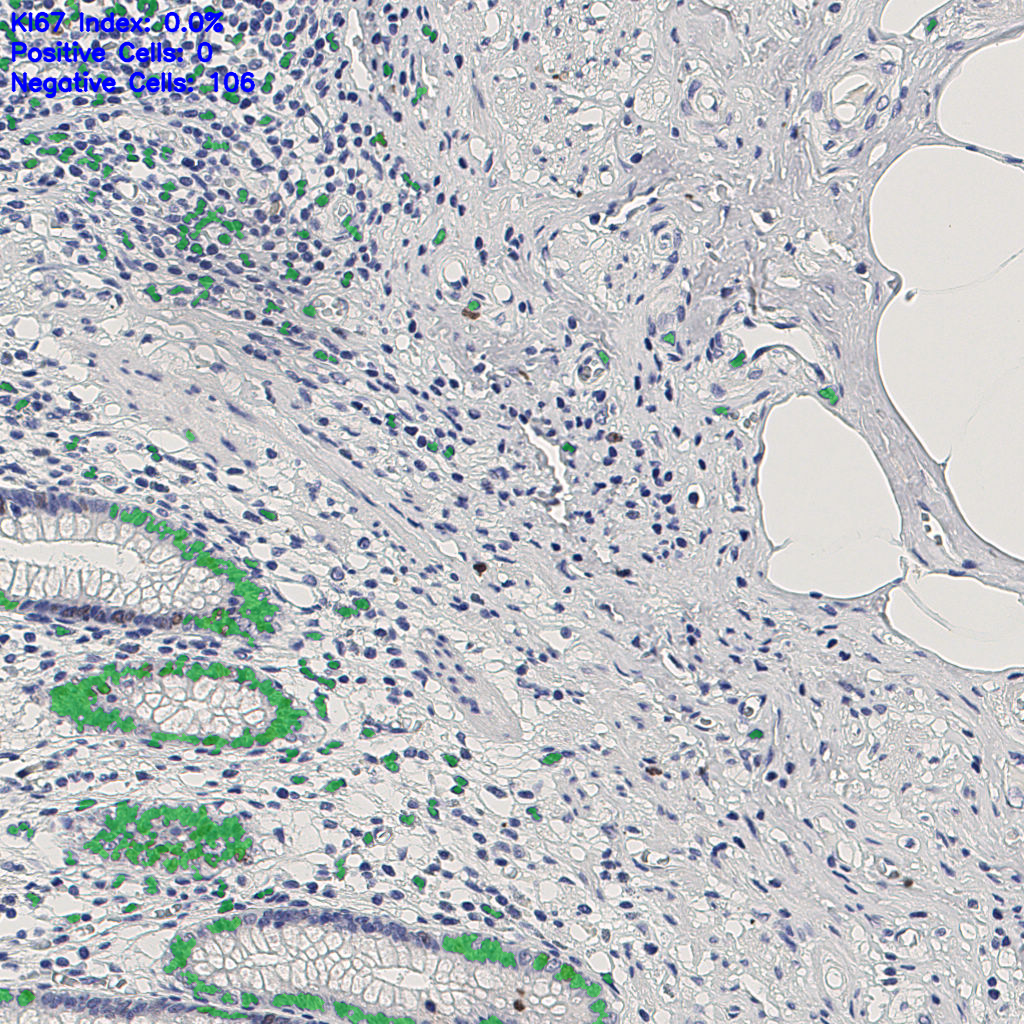 slice_10_25_x8960_y22400.png