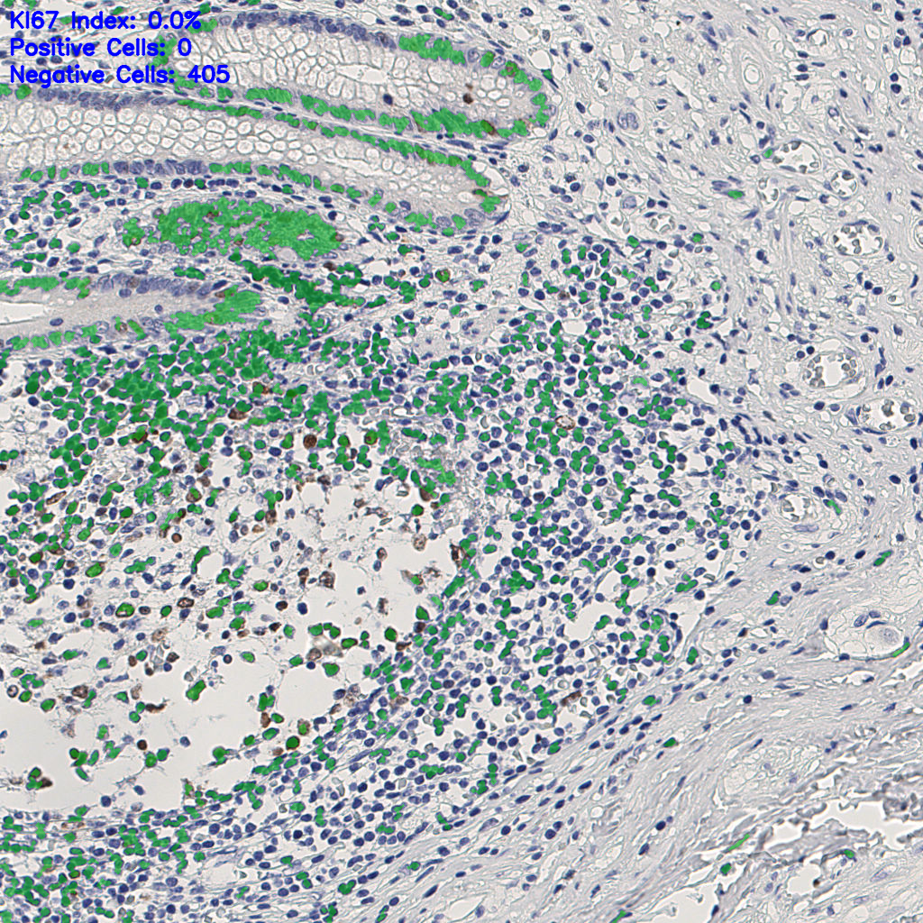 slice_10_26_x8960_y23296.png