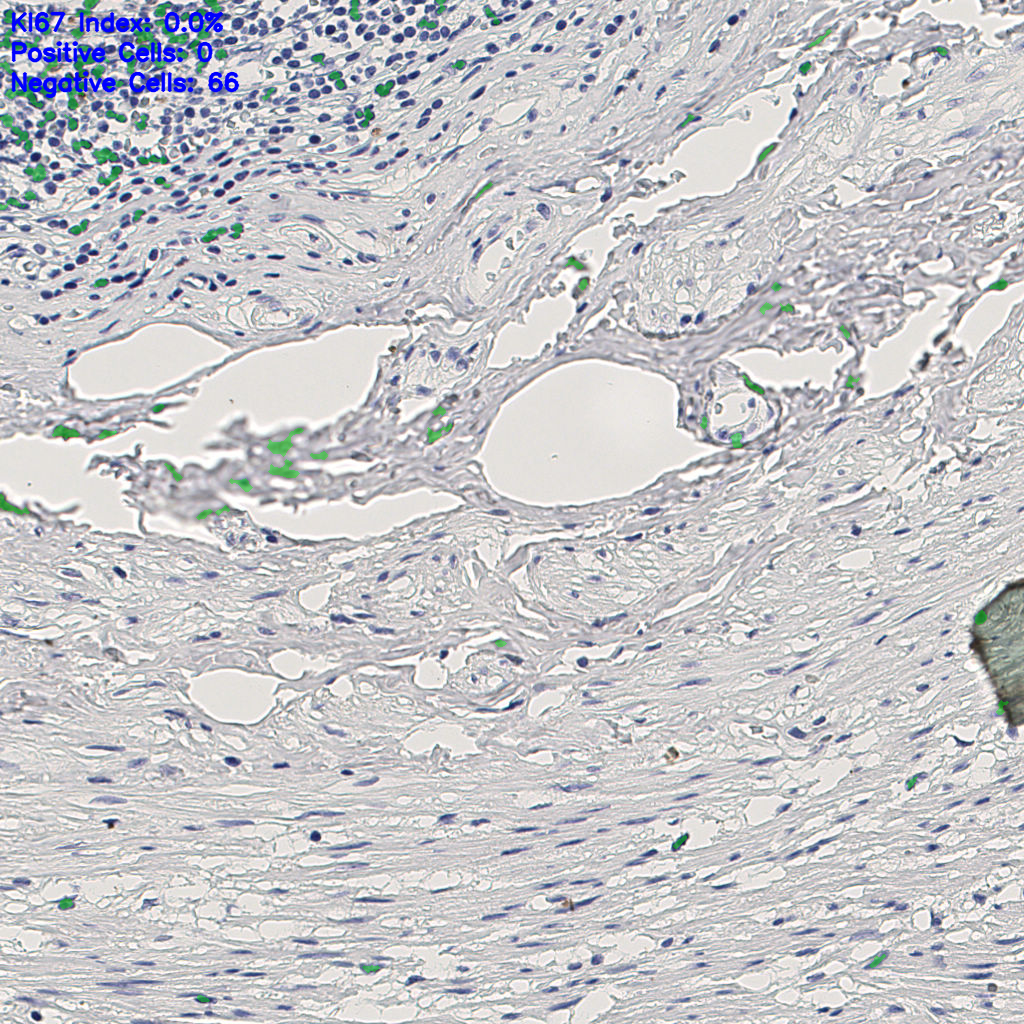 slice_10_27_x8960_y24192.png