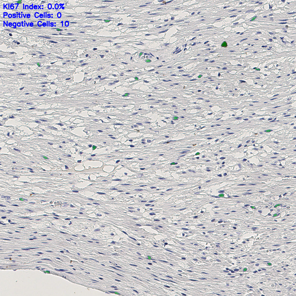 slice_10_28_x8960_y25088.png