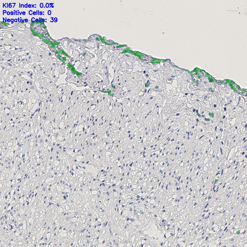 slice_11_19_x9856_y17024.png