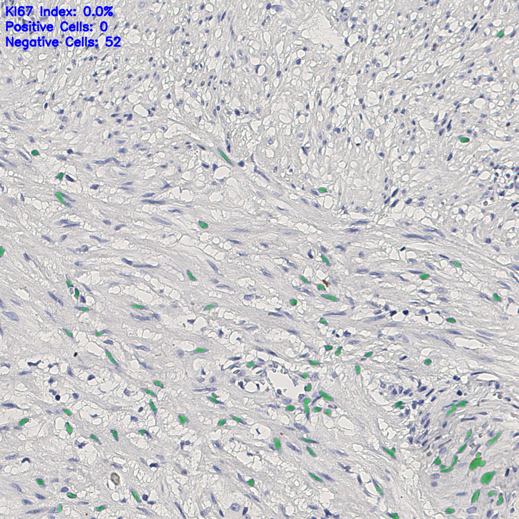 slice_11_20_x9856_y17920.png